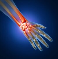 Occupational Disease
